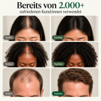 EVEROOTS Korean Scalp Revival Bar